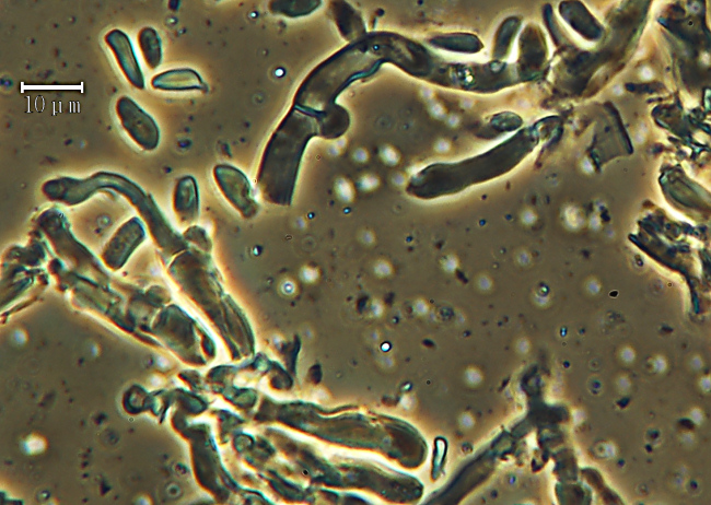 Crustoderma dryinum (Berk. & M.A. Curtis) Parmasto